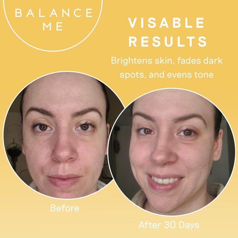 Balance Me Vitamin C Repair Serum, Brightening Face Serum with Hyaluronic Acid, Anti-Aging Vitamin C Serum for Dark Spots, Uneven Tone & Dull Skin, Hydrating & Natural Skincare, (1 x 1.01 fl oz) - Image 4